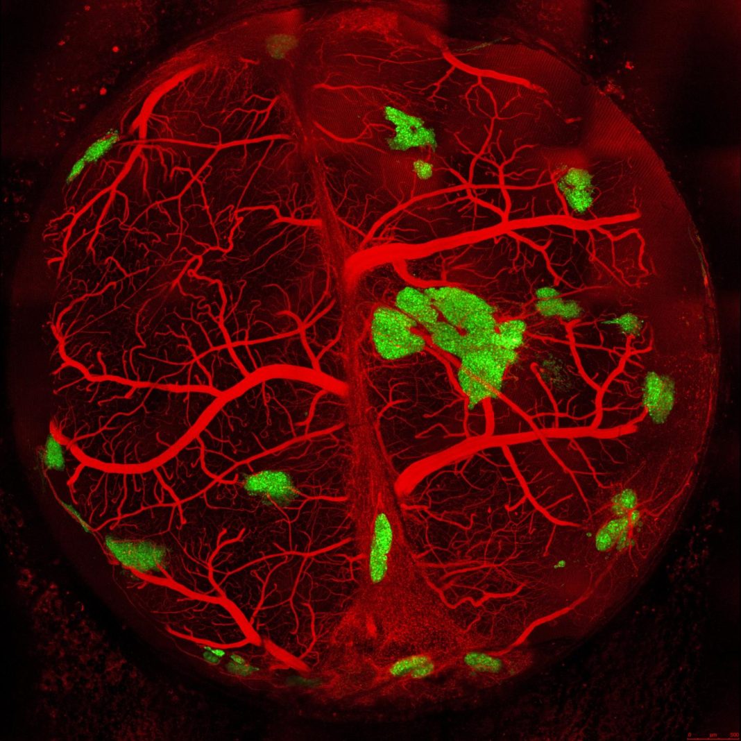 Vascularized pancreatic islets (areas in green) bioengineered by researchers and transplanted into a mouse. The bioengineered islets