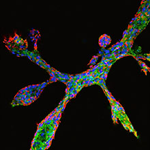 Detail of breast epithelial cells in culture undergoing ductal elongation and side-branching. [Haruko Miura, © Helmholtz Zentrum Munich]