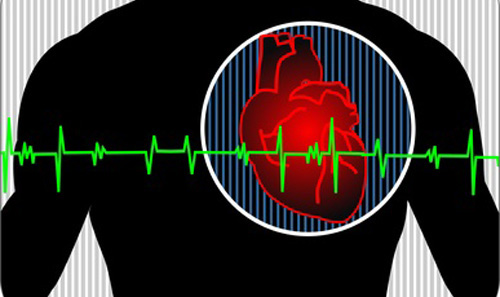 SCIPIO trial in patients with ischemic cardiomyopathy found that treatment also reduces infarct size.[© vishnukumar - Fotolia.com]