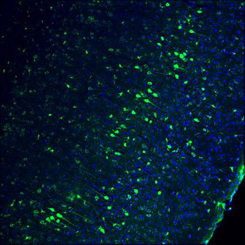 In this image of the adult mouse brain, cell nuclei are blue and genome-edited neurons are green. The image demonstrates the effectiveness of a homology-independent gene-editing technique, which has also shown promise in a rat model of retinitis pigmentosa. [Salk Institute]