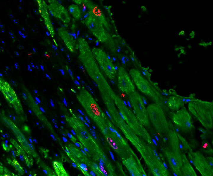 Cardiomyocytes (shown in green) proliferating in a mouse heart after gel injection. [University of Pennsylvania]