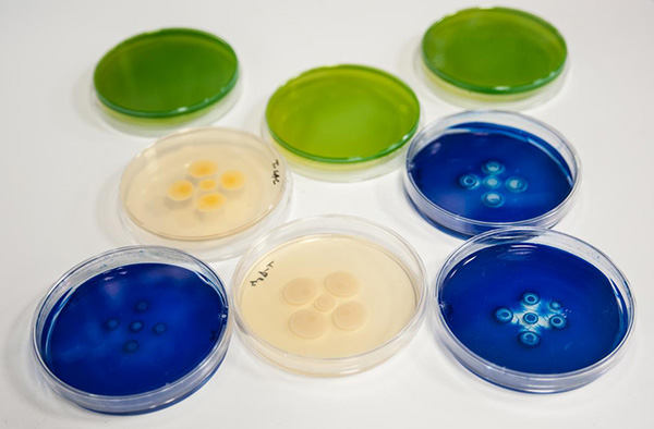 Superbugs in the laboratory. [Andrés Díaz/CSIC Communication]