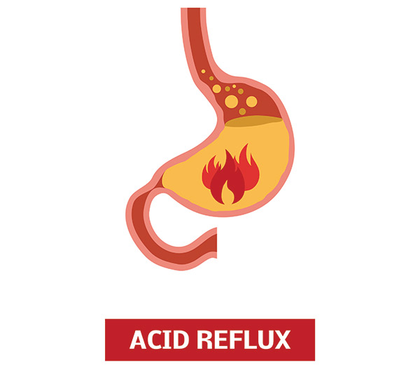 Popular Acid Reflux Drugs Promote Chronic Liver Disease