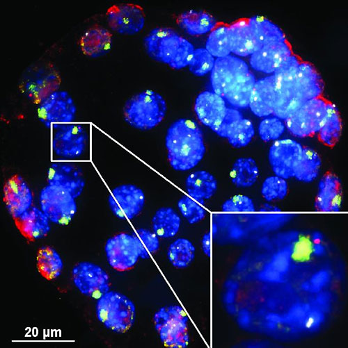 In these mouse embryo cells, XistAR RNA strands show up in red, and the Xist RNA whose production they trigger show up in green. The team that made this image had to develop a new way to detect antisense lncRNA in order to see XistAR. [University of Michigan]