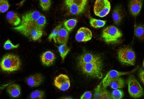Immunofluorescence staining for PARP9  (red) and PARP14 (green) with nuclei  shown in blue. [Brigham and Women's Hospital]