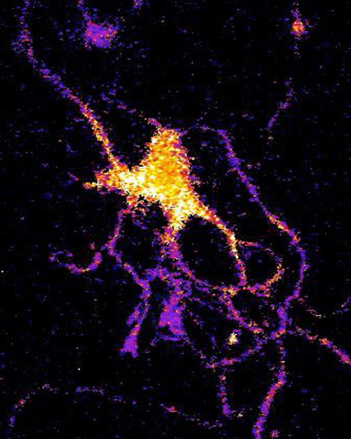 Individual neuron glowing with bioluminescent light produced by a new genetically engineered sensor. [Johnson Lab/Vanderbilt University]