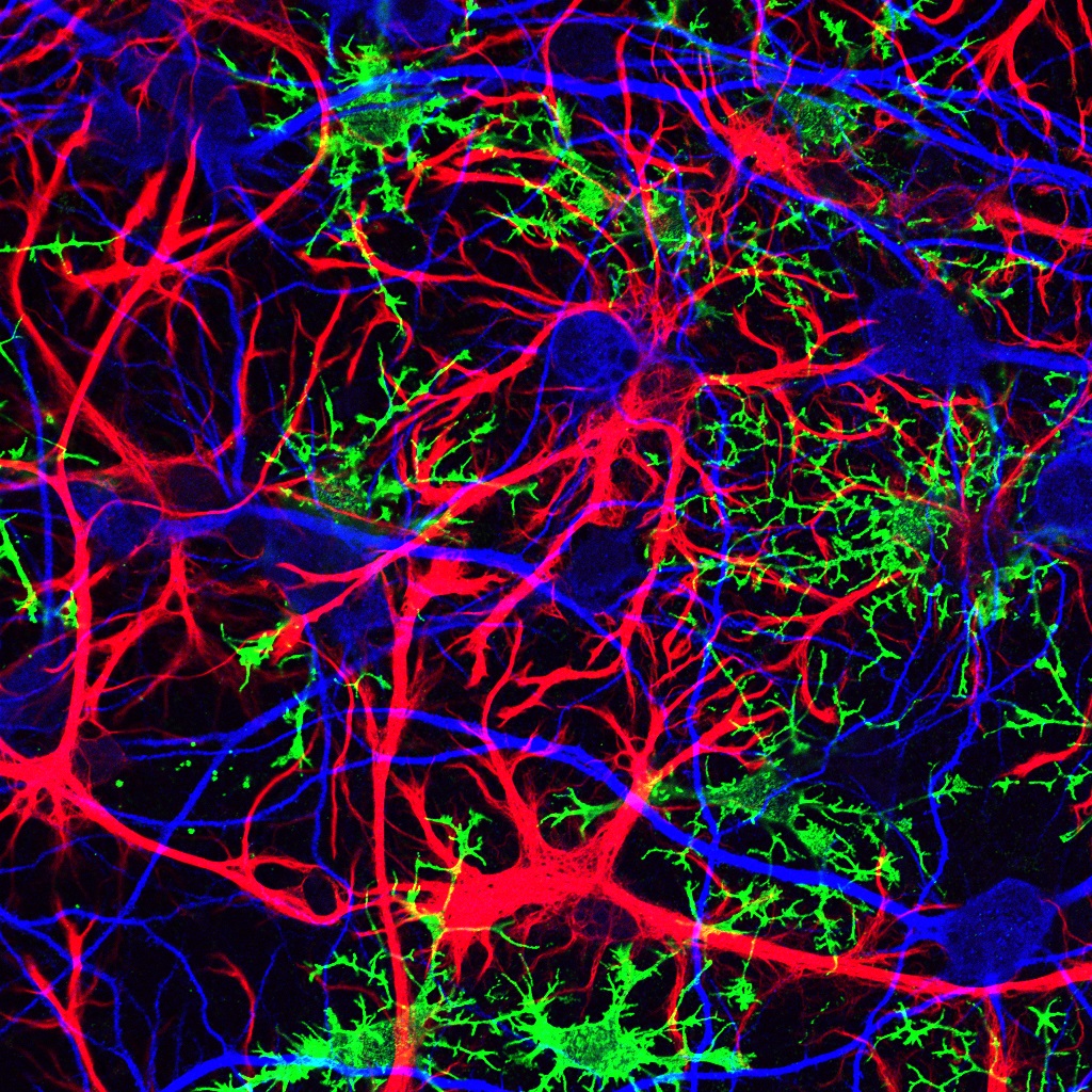 Как называются клетки головного мозга. Клетки головного мозга астроциты. Нейроны мозга. Нейронная клетка. Нейронные связи головного мозга.