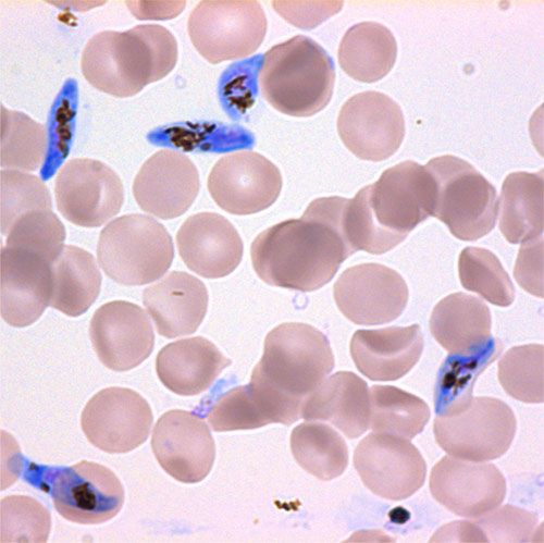 In blue are <i>Plasmodium falciparum</i> malaria parasites in the sexual