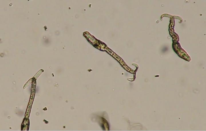schistosomiasis infection