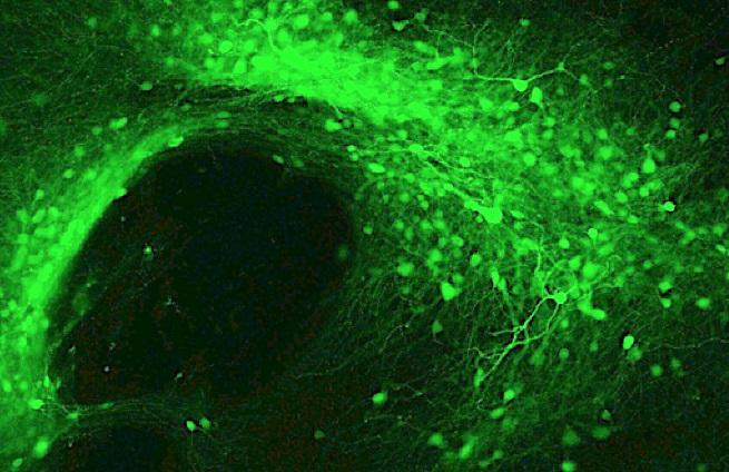 Green fluorescent protein expressed in neurons of the nucleus accumbens, a critical brain region involved in drug addiction. [Dr. Christopher Cowan/Medical University of South Carolina]