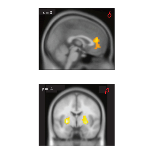 Brain scans taken during a competitive game show high activity in the prefrontal cortex (top) and striatum (bottom). In these regions