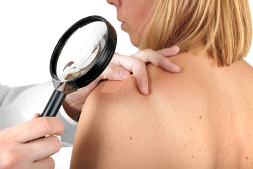 BMS reports this is the first new treatment for unresectable metastatic melanoma in over a decade.[M&S Fotodesign-Fotolia.com]