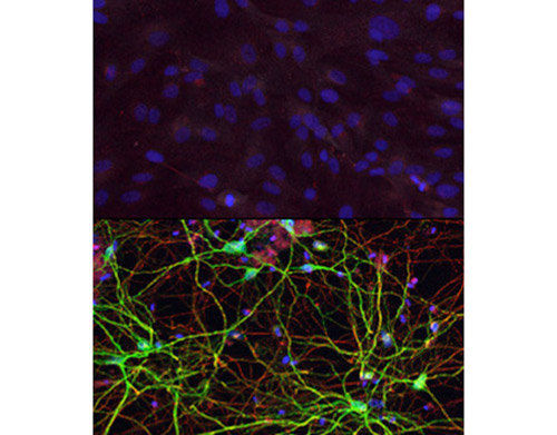 Human skin cells (top) can be converted into medium spiny neurons (bottom) with exposure to the right combination of microRNAs and transcription factors. [Yoo Laboratory