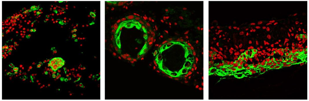 Shown above are two types of progenitor cells from dissociated skin—epidermal (green) and dermal (red)—undergo a series of morphological transitions to form reconstituted skin. [Mingxing Lei/Cheng-Ming Chuong Lab]