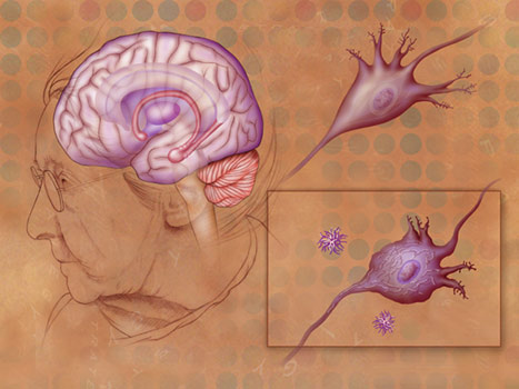 Tau pathology may be more closely connected to loss of brain function with advancing age. [NIH]
