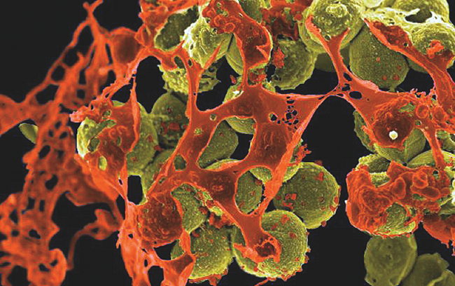 Scanning electron micrograph of MRSA (yellow) surrounded by cellular debris (orange). [NIAID]