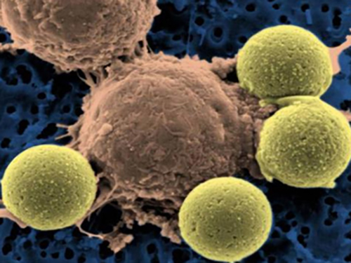 An engineered CAR T cell (center) binding to beads, which causes the T cell to divide. In CAR T-cell therapy, the engineered T cells are expanded into the hundreds of millions and then infused back into the patient. [NIH]