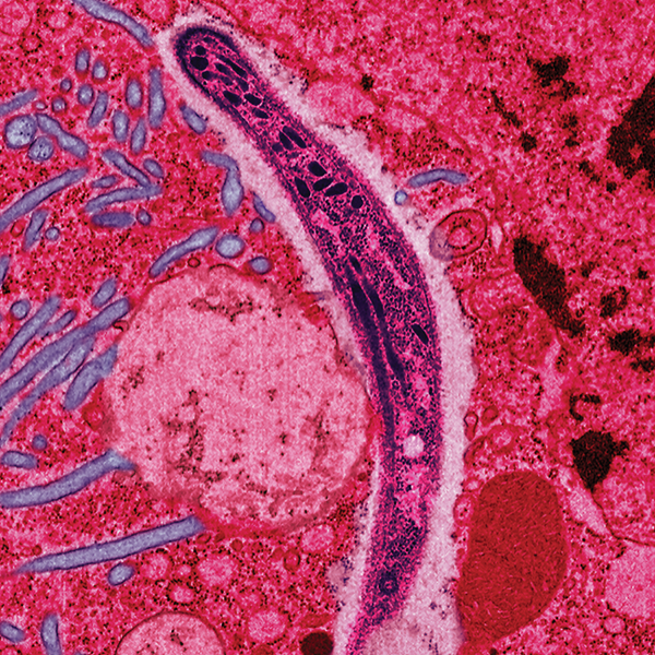 Preventing the spread of parasite gametocytes (above) through host immune response may prevent the spread of parasitic infections like malaria. [NIH]