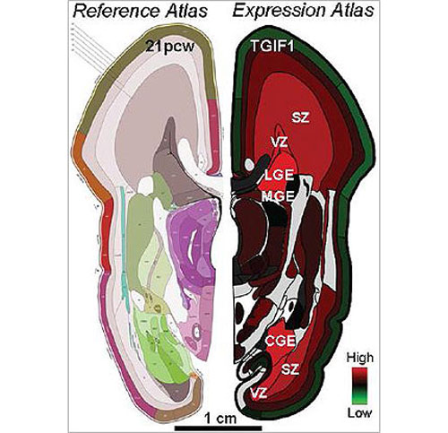 The BrainSpan Atlas incorporates gene activity or expression (right) along with anatomical reference atlases (left) and neuroimaging data (not shown) of the mid-gestational human brain. Here the TGIF1 gene is highlighted. [NIH]