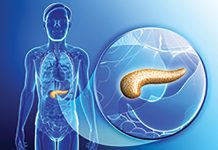 Biomarkers Identified to Help Predict Risk of Pancreatic Cyst Progression to Cancer