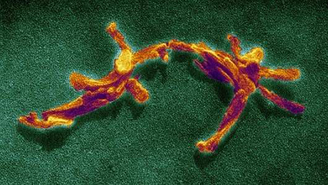 Artificial Human Prions Created in the Lab