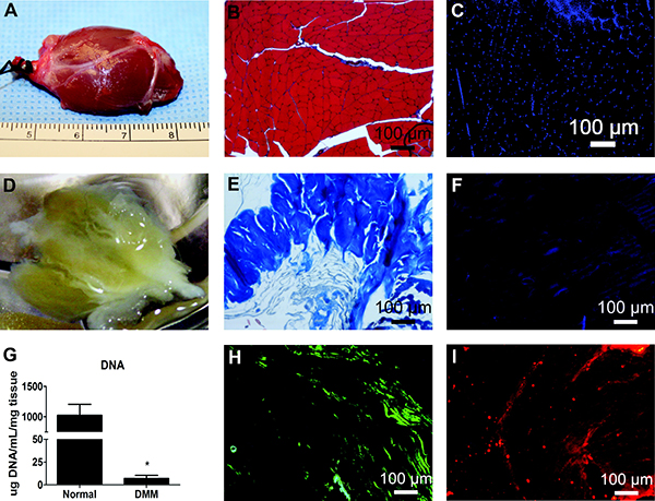 Decellularized Muscle Supports New Muscle Fibers and Improves Function Following Volumetric Injury