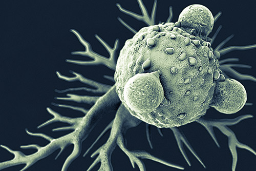 Pharmaceutical Companies Race to Build CAR T-Cell Manufacturing Processes