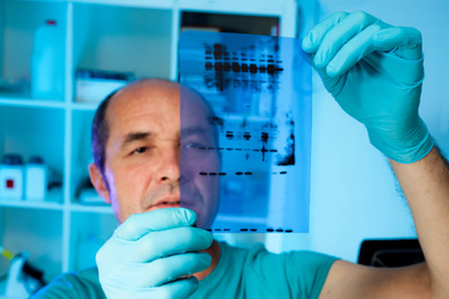 5 Tips for Your Best Western Blots