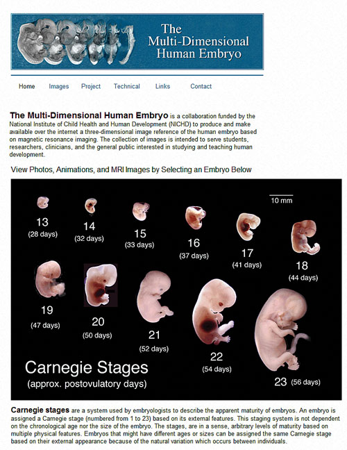 The Multi-Dimensional Human Embryo