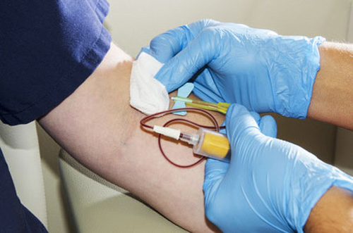 NIH Blood Test Developed for Liver Cancer Screening