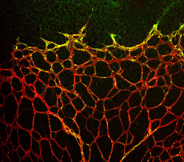 Stem Cells in Blood Might Be Used to Grow New Blood Vessels