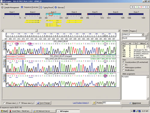 Sequencing-Based HLA Typing Using RNA