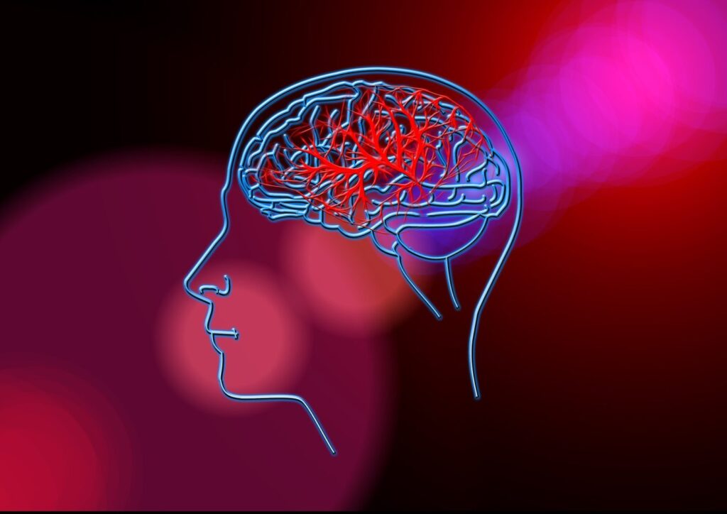 brain - stroke