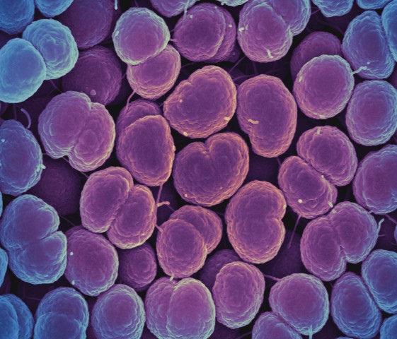 Gonorrhea Gets Promising New Antibiotic Treatment