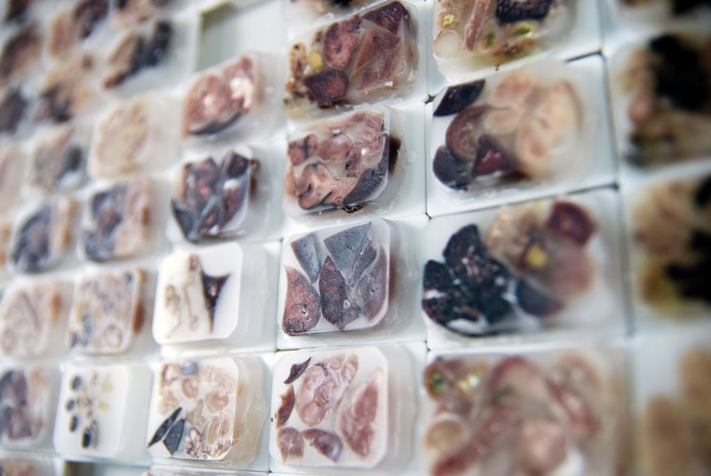 paraffin-embedded tissues