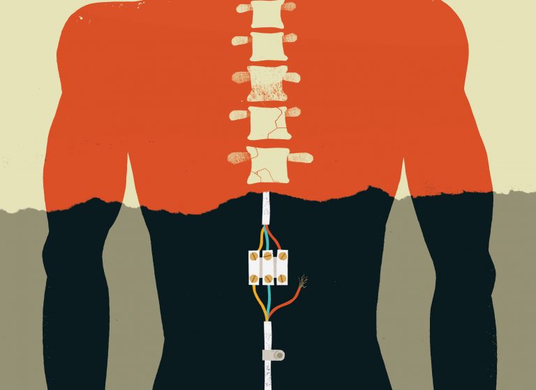 One-Time Injection Restores Breathing and Limb Function after Spinal Cord Injury