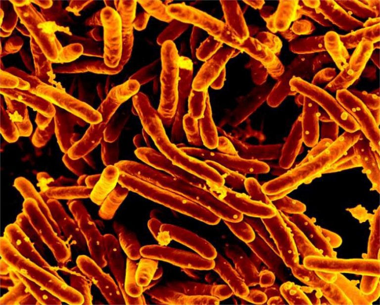 Tuberculosis Susceptibility Could be in Your Genes