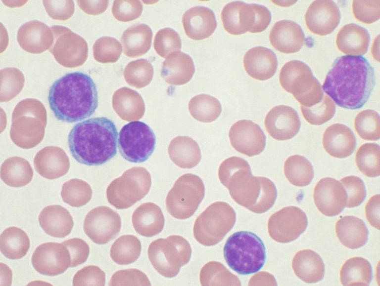 FDA Approves First Non-Chemo Combination Therapy for a Form of Leukemia