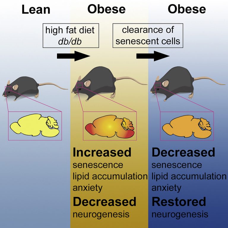 Obesity-Driven Anxiety Lessens When Old Brain Cells Are Eliminated
