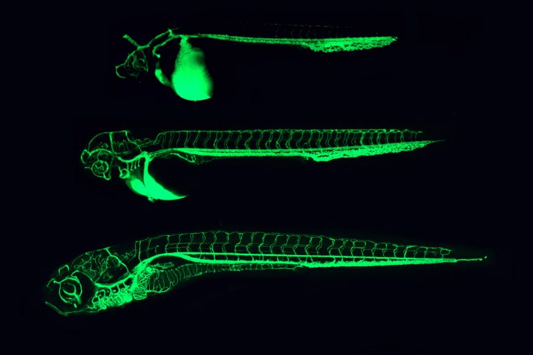 Quantitative Microscopy of Angiogenesis in Zebrafish Embryos