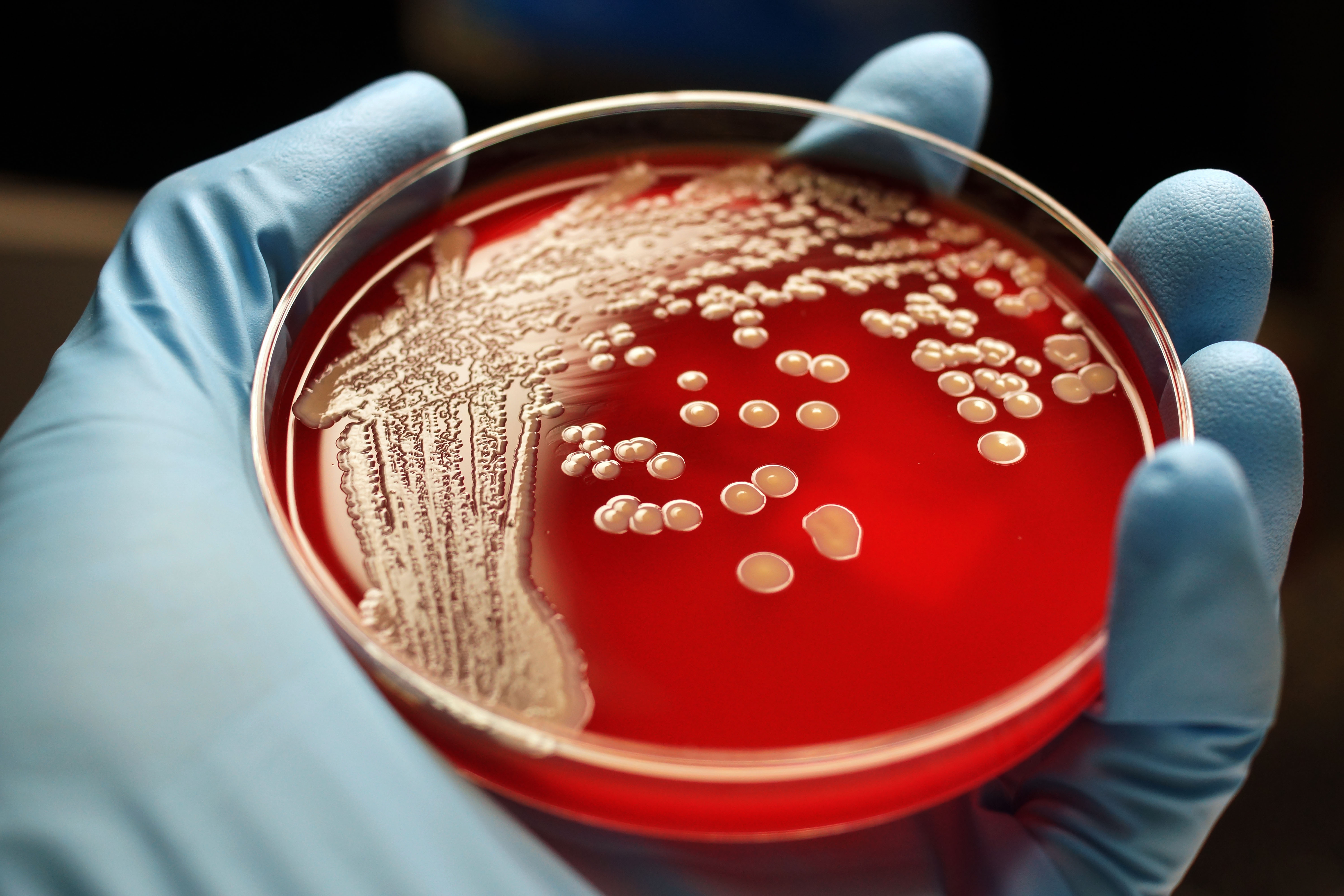 Бактерии staphylococcus aureus. Золотистый стафилококк MRSA. Чашка Петри с бактериями стафилококки. Стафилококк сапрофитикус. Стафилококк ауреус бактериологическое исследование.