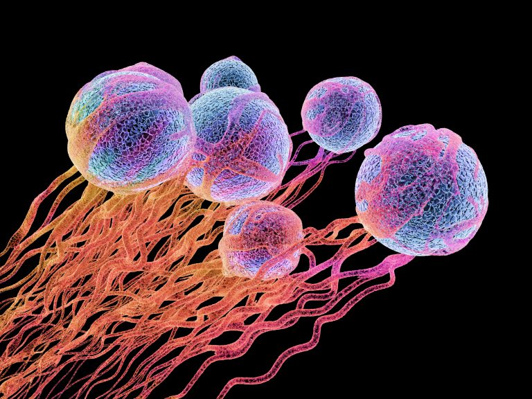 Culprit Behind Increase of Radioresistant Cancer Cells Revealed