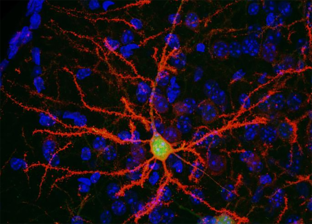 Brain effect. Нейроны. Нейрон фото. Нейробиология. Нейронные связи картинки.