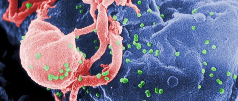 HIV Protein Trains Immune Cells to Be Hyper-Responsive, Resulting in Chronic Inflammation