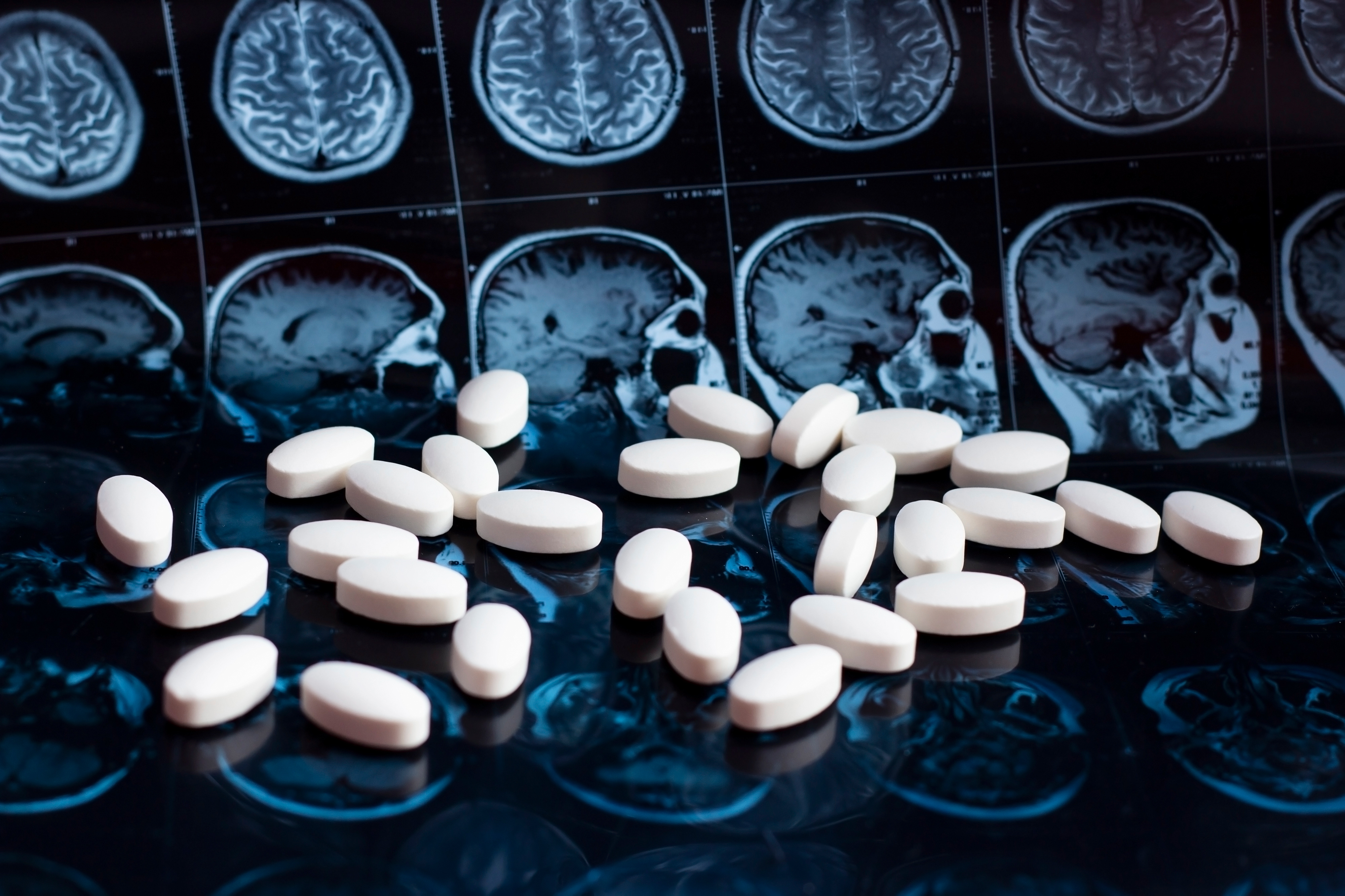 What Drugs Increase Blood Flow to the Brain?