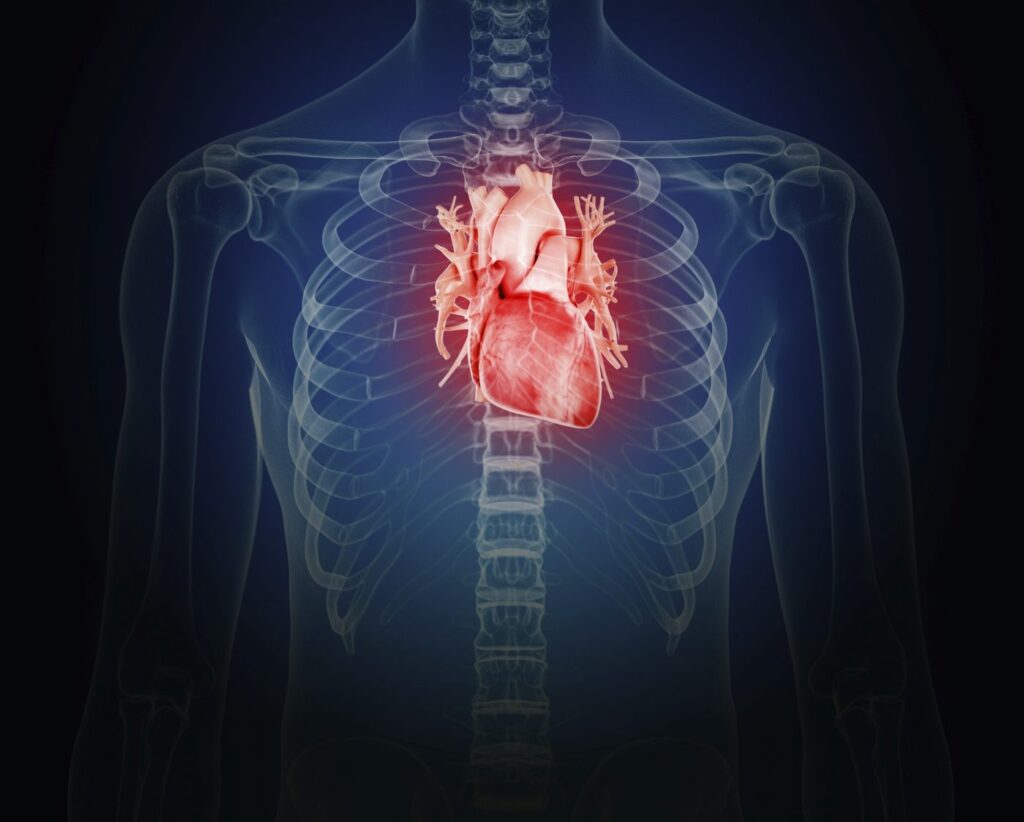 Illustration of an inflamed heart