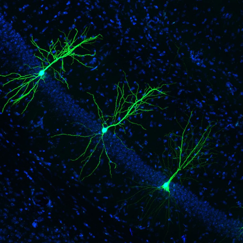 Healthy dendritic spines