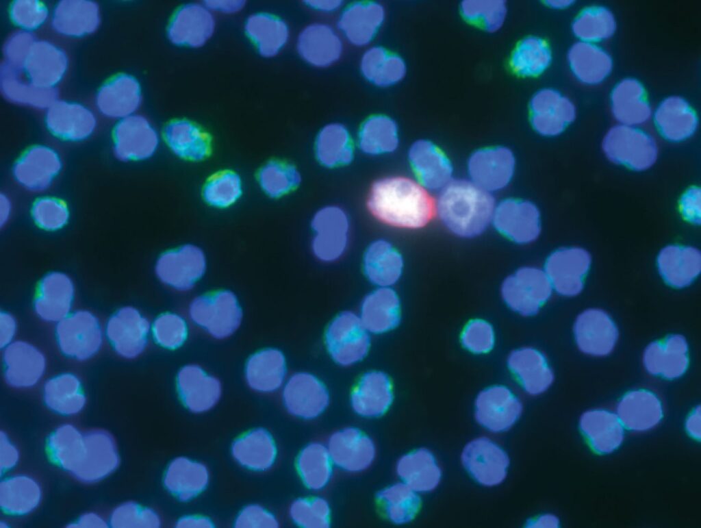 Epic Sciences’ Functional Cell Profiling (FCP)