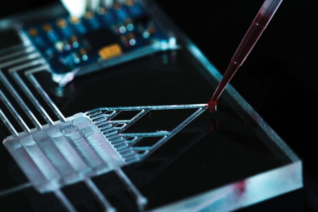 Microfluidic lab-on-a-chip
