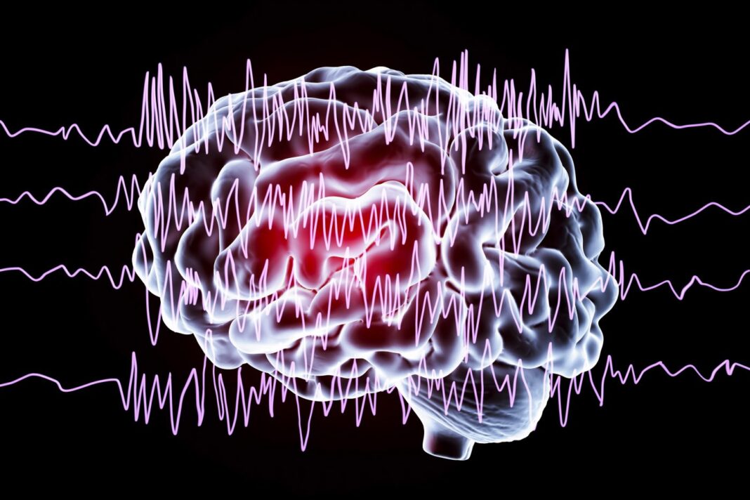 Brain and brain waves in epilepsy, illustration